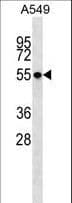 STK17B / DRAK2 Antibody (aa320-348)