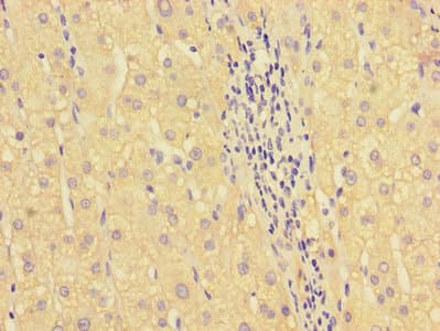 HOXA2 Antibody
