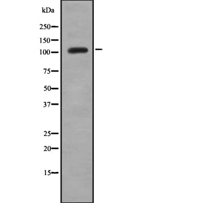 TMPRSS15 / Enterokinase Antibody (aa510-529)