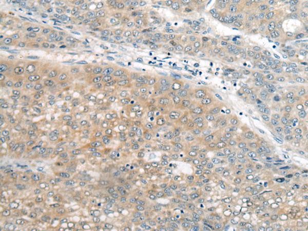 Polyclonal Rabbit anti-Human UBE2G2 Antibody (IHC)