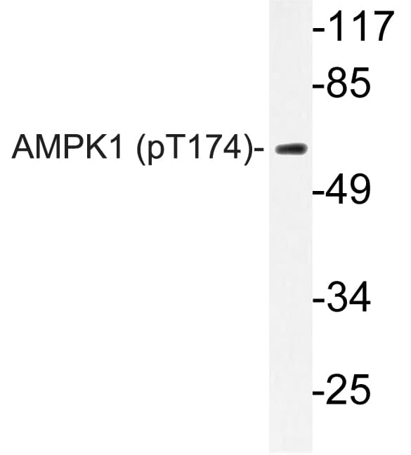 Polyclonal Rabbit anti-Human PRKAA1 / AMPK Alpha 1 Antibody (phospho-Thr174, IHC, WB)