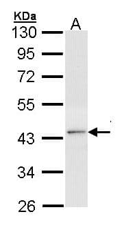 NR1A2 / THRB Antibody