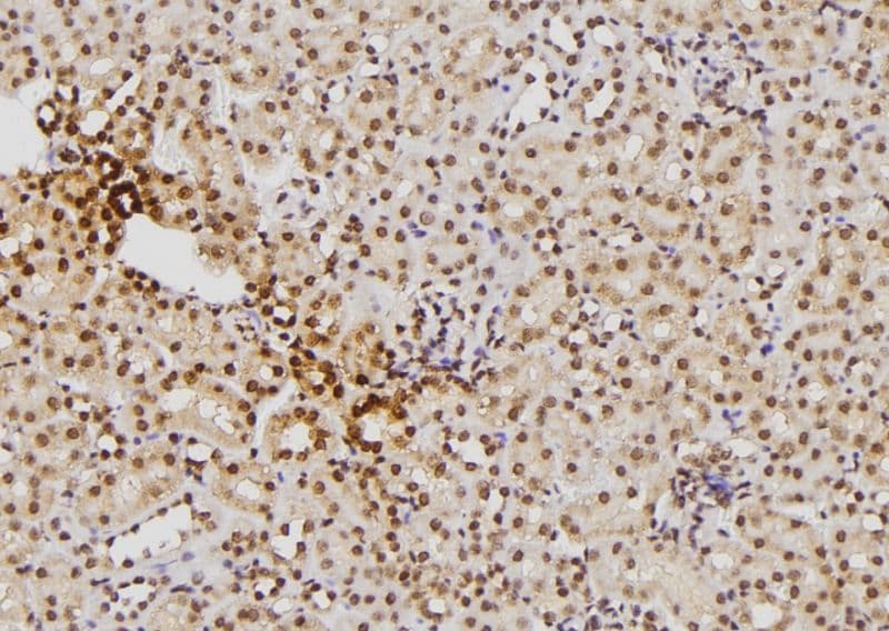 S100B / S100 Beta Antibody