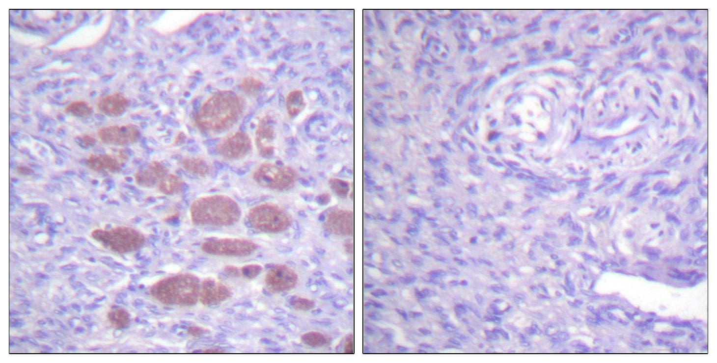 Polyclonal Rabbit anti-Human P40PHOX / NCF4 Antibody (IHC)