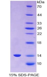 Human VG5Q / AGGF1 Protein (Recombinant His)