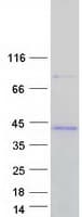 Human RAB34 Protein (Recombinant Myc-DDK (Flag))