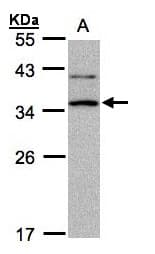 XRCC2 Antibody (aa1-123)
