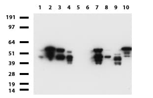 Vimentin Antibody (aa210-466, clone UMAB159)