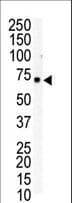 EPHB6 / EPH Receptor B6 Antibody (aa990-1021)