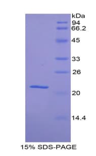 Dog HP / Haptoglobin Protein (Recombinant His)