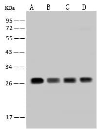 Polyclonal Rabbit anti-Human TPD52L2 / HD54 Antibody (IHC, IF, WB)
