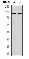 Polyclonal Rabbit anti-Human XPO1 / CRM1 Antibody (Acetyl-Lys568, WB)