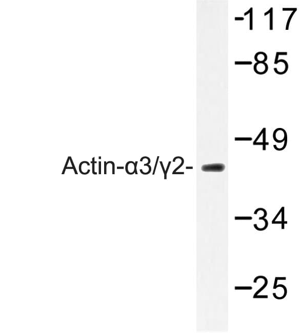 ACTA3 / ACTG2 Antibody (Glu2)
