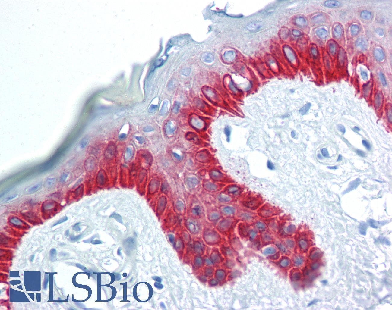IHC-plus™ Cytokeratin 5+6 Antibody (clone ABT-CK5/6)