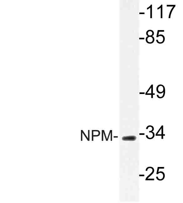 NPM1 / NPM / Nucleophosmin Antibody (Lys230)