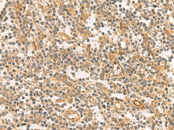 Polyclonal Rabbit anti-Human PPM1M Antibody (IHC)