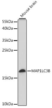 Polyclonal Rabbit anti-Human MAP1LC3B / LC3B Antibody (IHC, IF, WB)