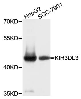 Polyclonal Rabbit anti-Human KIR3DL3 / CD158z Antibody (WB)