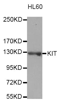 Polyclonal Rabbit anti-Human c-Kit / CD117 Antibody (IHC, WB)
