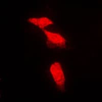 PPP2R5A Antibody (Internal)
