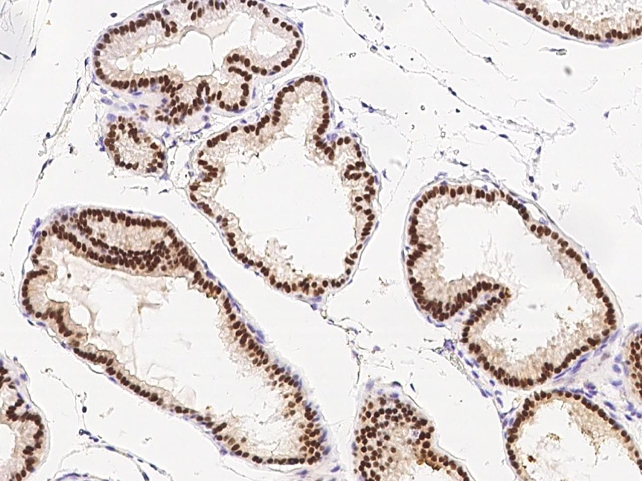 FOXA1 Antibody (Preservative Free)
