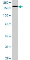 TEK / TIE2 Antibody (clone 3A5)