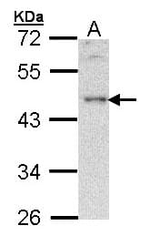 BLNK Antibody (aa394-456)