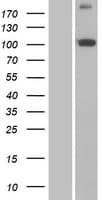 PITRM1 / MP1 Protein (Over-Expression Lysate Myc-DDK (Flag))