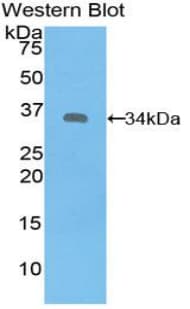 SYK Antibody (aa374-635)