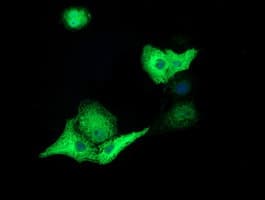 ERIC-1 / TACC3 Antibody (clone OTI8B7)