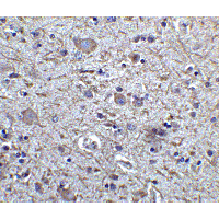 FOXP3 Antibody