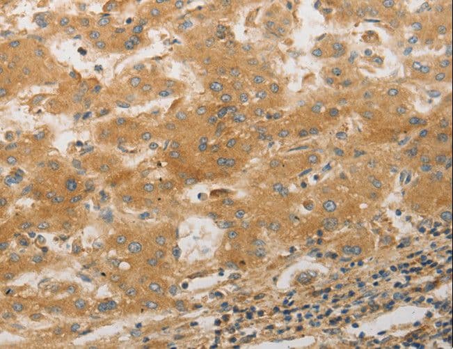 Polyclonal Rabbit anti-Human PAP2a / PPAP2A Antibody (IHC)