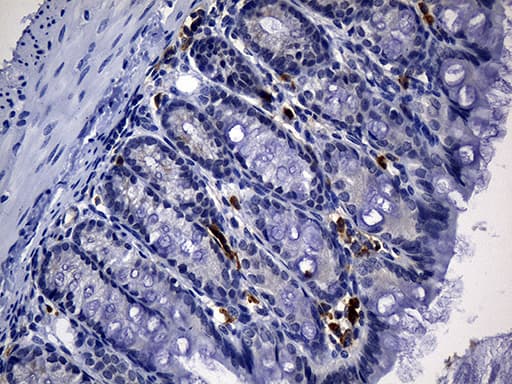 CD2 Antibody (clone UMAB6)