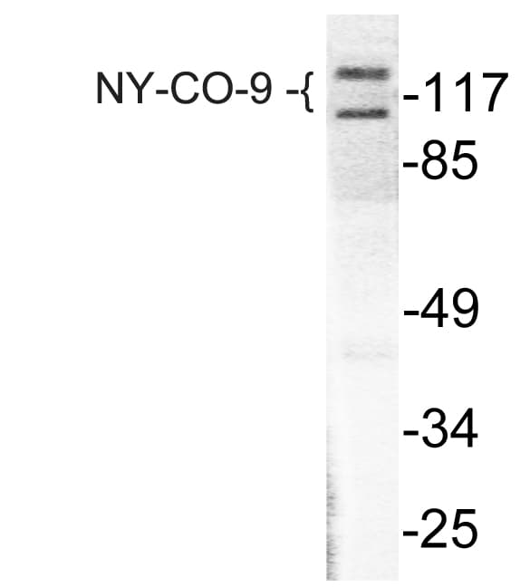 HDAC5 Antibody (Glu1106)
