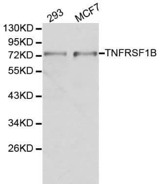 Polyclonal Rabbit anti-Human TNFRSF1B / TNFR2 Antibody (IHC, WB)