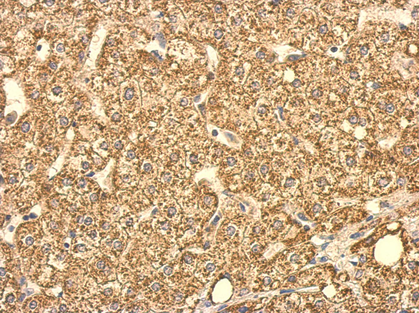 SUCLG2 Antibody (aa1-234)