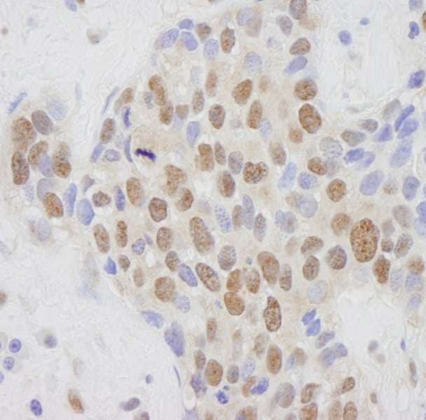 Polyclonal Rabbit anti-Human MED1 / TRAP220 Antibody (aa1525-C-term, IHC)