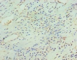 SIRT3 / Sirtuin 3 Antibody (aa20-130)