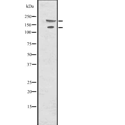 Polyclonal Rabbit anti-Human COL17A1 / Collagen XVII Antibody (IHC, IF, WB)