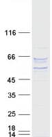 Human P4HA2 Protein (Recombinant Myc-DDK (Flag))