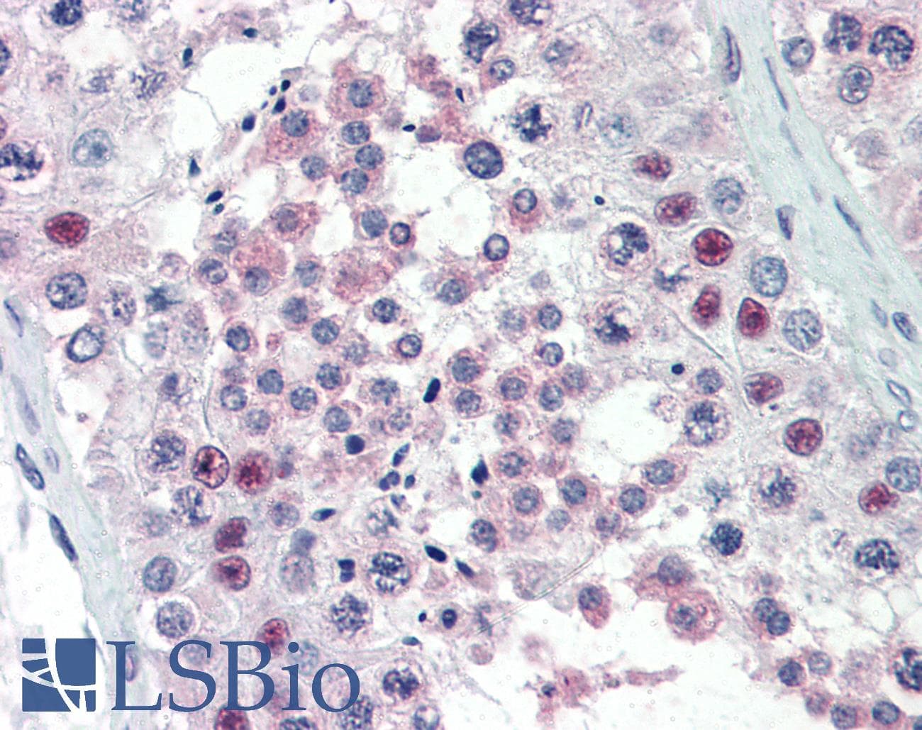 IHC-plus™ PRMT5 Antibody (aa100)