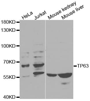 Polyclonal Rabbit anti-Human TP63 / p63 Antibody (IHC, IF, WB)