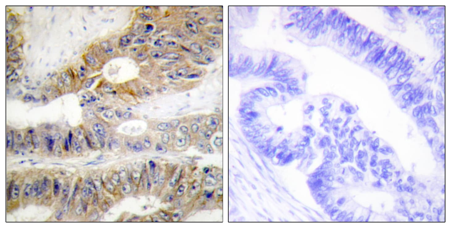 TNFRSF6B / DCR3 Antibody (aa251-300)