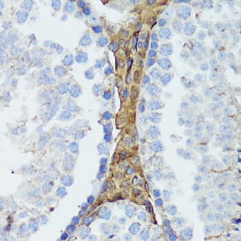 Polyclonal Rabbit anti-Human HTRA3 Antibody (IHC, WB)