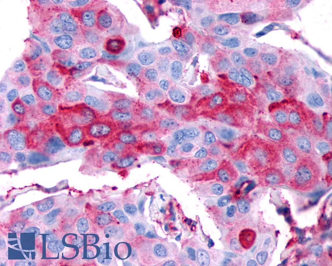 PathPlus™ Polyclonal Rabbit anti-Human RXFP2 / LGR8 Antibody (Cytoplasmic Domain, IHC, WB)