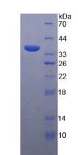 Human DEFB4A / BD-2 Protein (Recombinant His-GST, N-terminus)