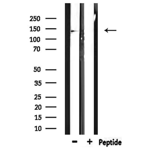 Polyclonal Rabbit anti-Human RNF123 Antibody (IHC, WB)