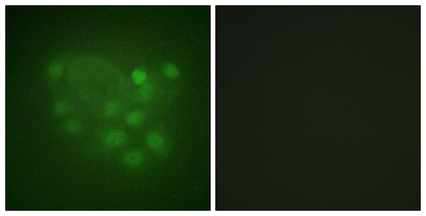 KIF2C / MCAK Antibody (aa61-110)