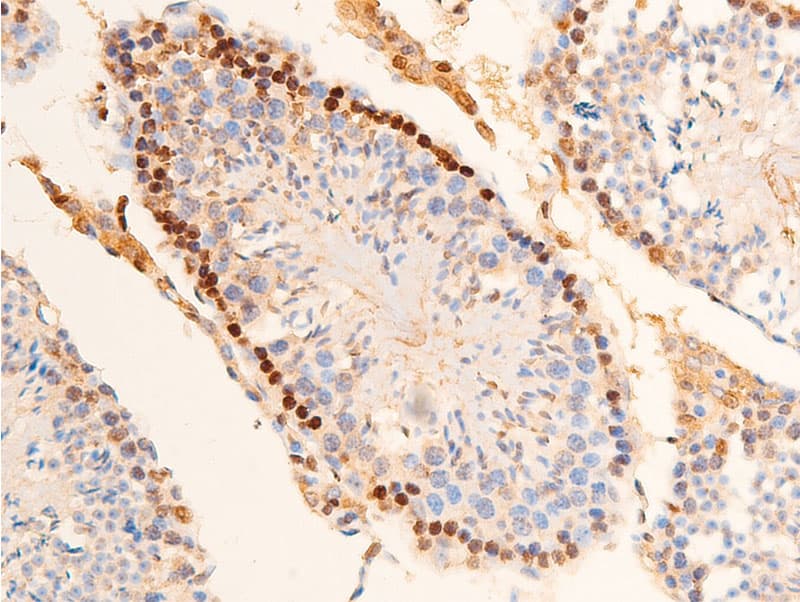 Polyclonal Rabbit anti-Human CHEK2 / CHK2 Antibody (phospho-Thr383, IHC, IF, WB)
