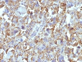 Macrophage + Histiocytoma Marker Antibody (clone D11)